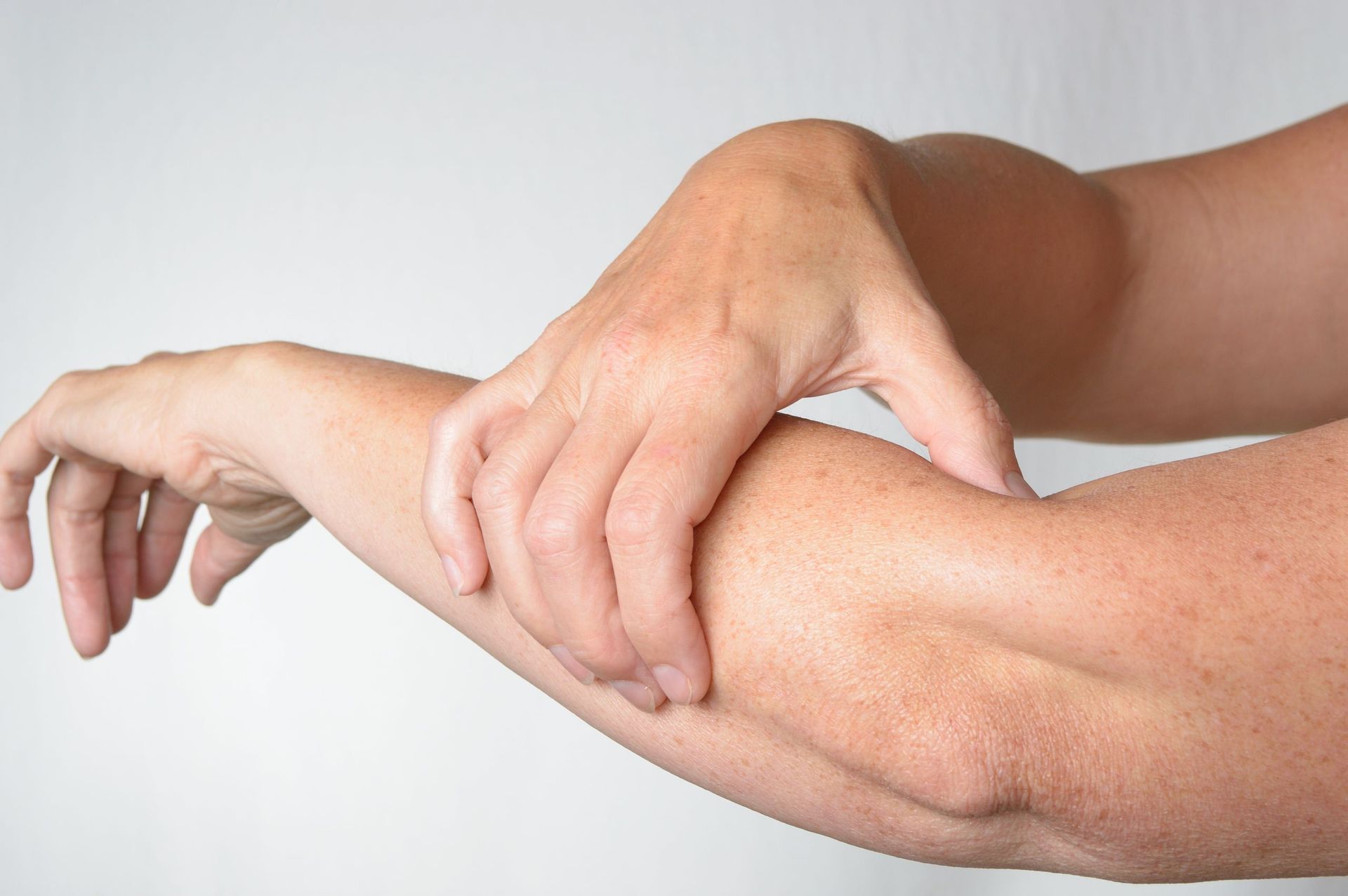 Eine Person kratzt sich mit der Hand am Arm.