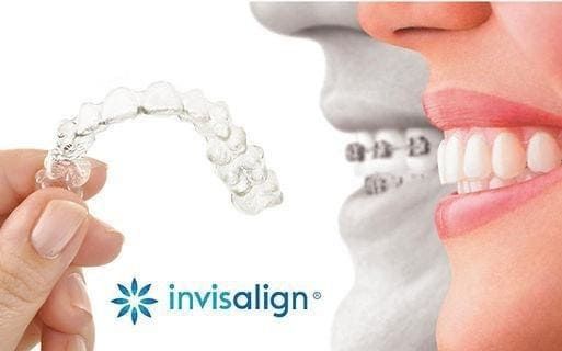 Alineador transparente Invisalign sostenido cerca de una boca sonriente con brackets y dientes.