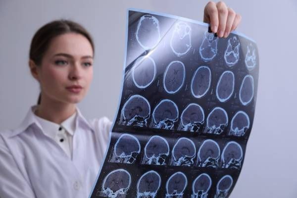 Mujer con bata blanca sosteniendo una hoja con imágenes de escáner cerebral.