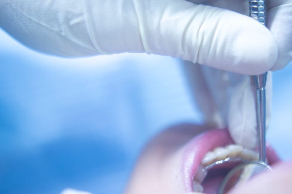 Dentista utilizando una herramienta para examinar la boca abierta de un paciente, detalle de primer plano