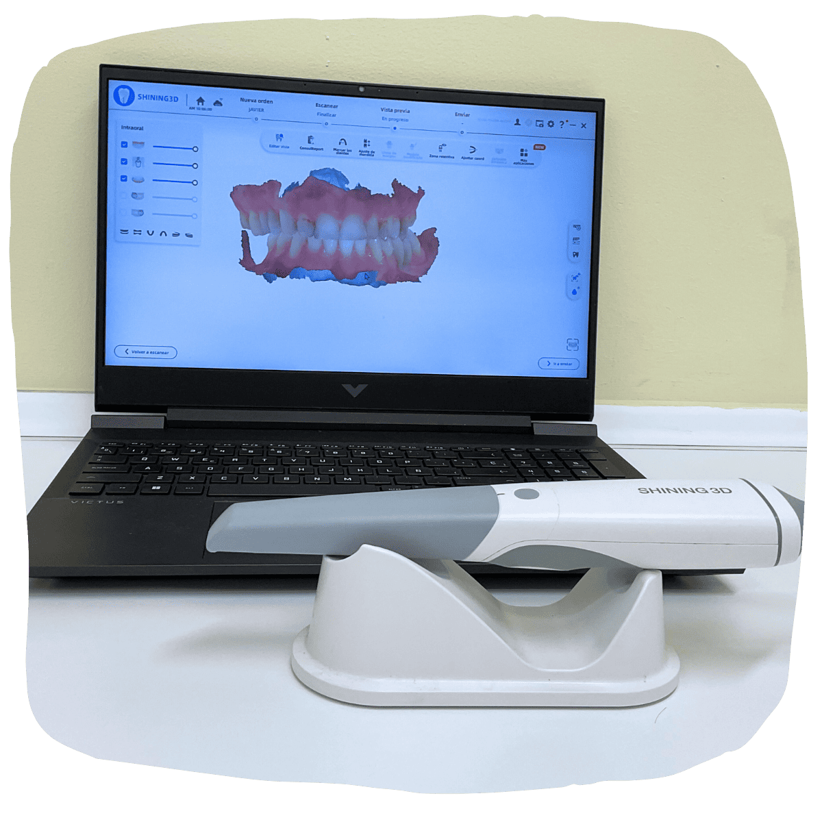 Portátil con escáner dental 3D, escáner portátil en estación de carga. Escritorio blanco, pared color crema.
