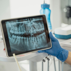 Mano del dentista en guante azul sosteniendo una tableta que muestra una radiografía de los dientes en el consultorio dental.