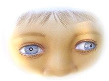 olhos de criança com estrabismo.