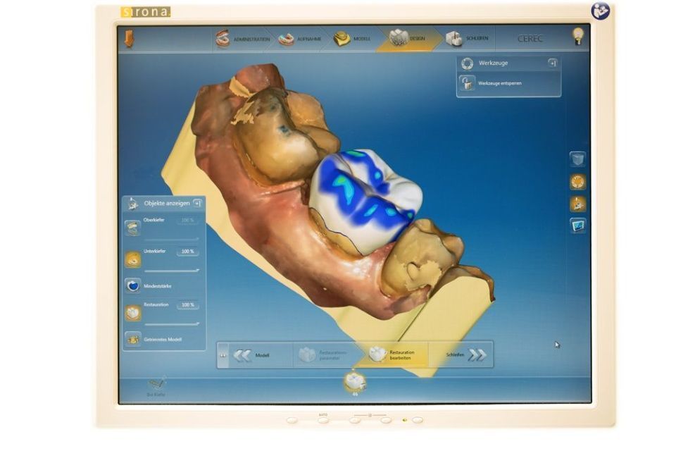 Cerec Screen - Zahnarztpraxis Cramm Muttenz
