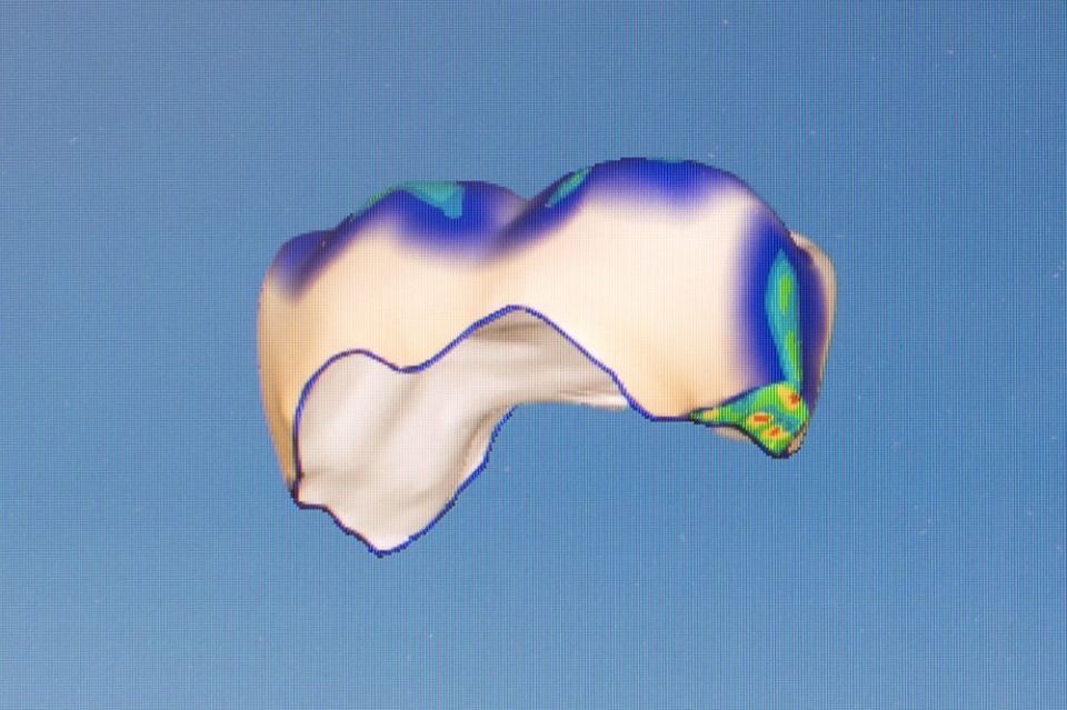 Cerec Screen - Zahnarztpraxis Cramm Muttenz
