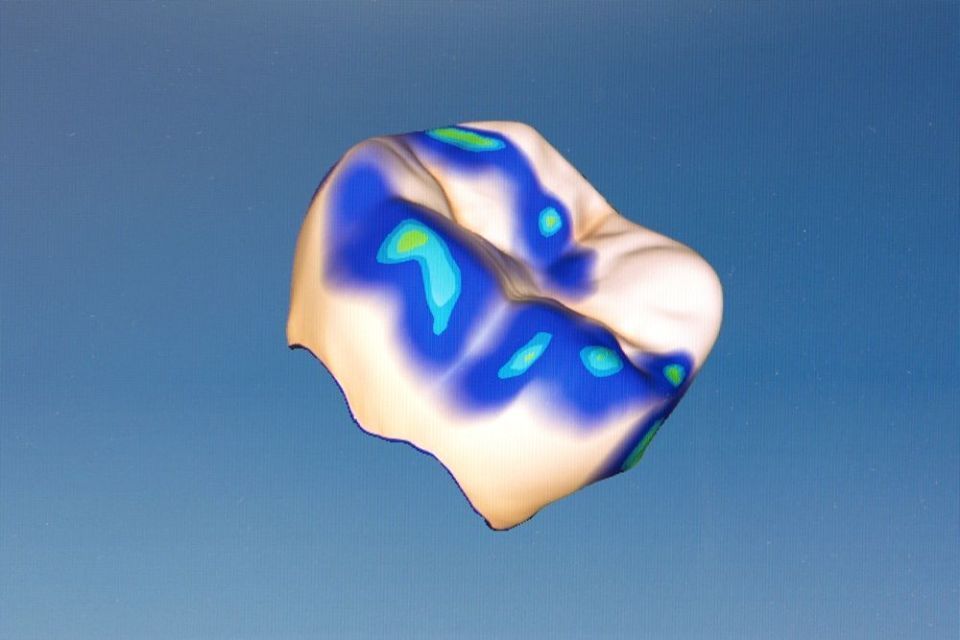 Cerec Screen - Zahnarztpraxis Cramm Muttenz
