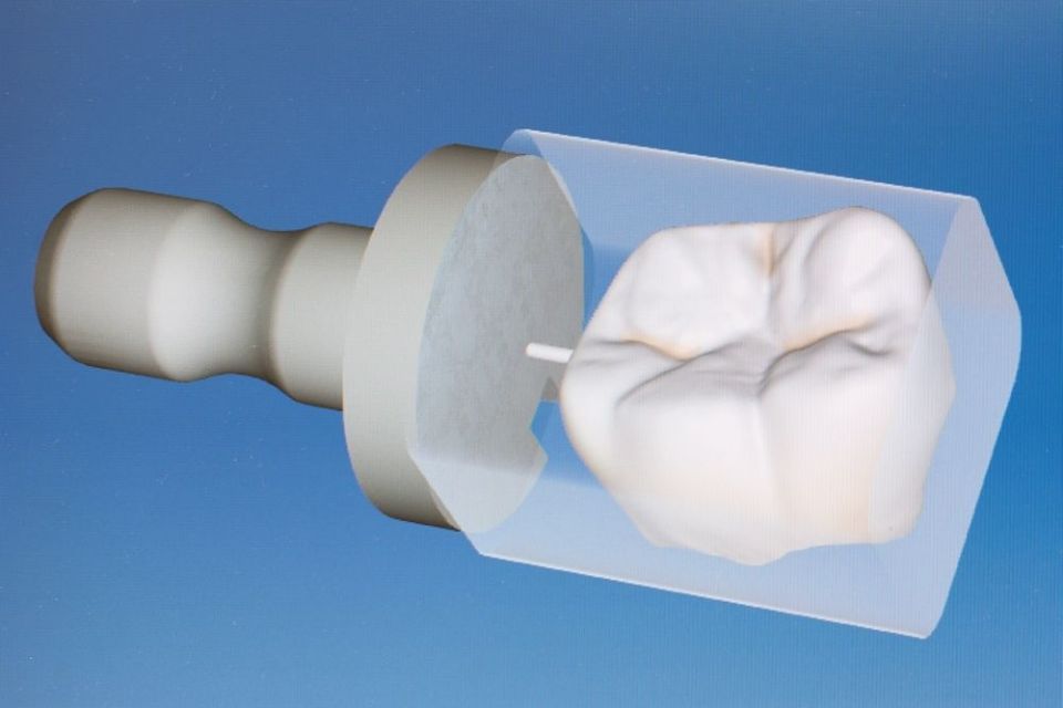 Cerec Screen - Zahnarztpraxis Cramm Muttenz
