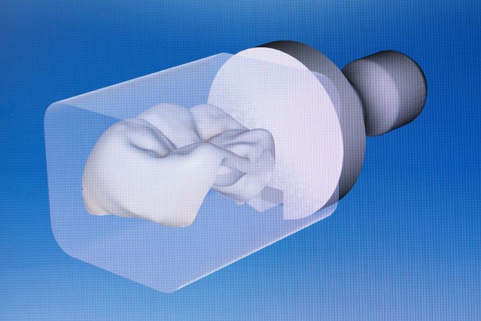 Cerec Screen - Zahnarztpraxis Cramm Muttenz
