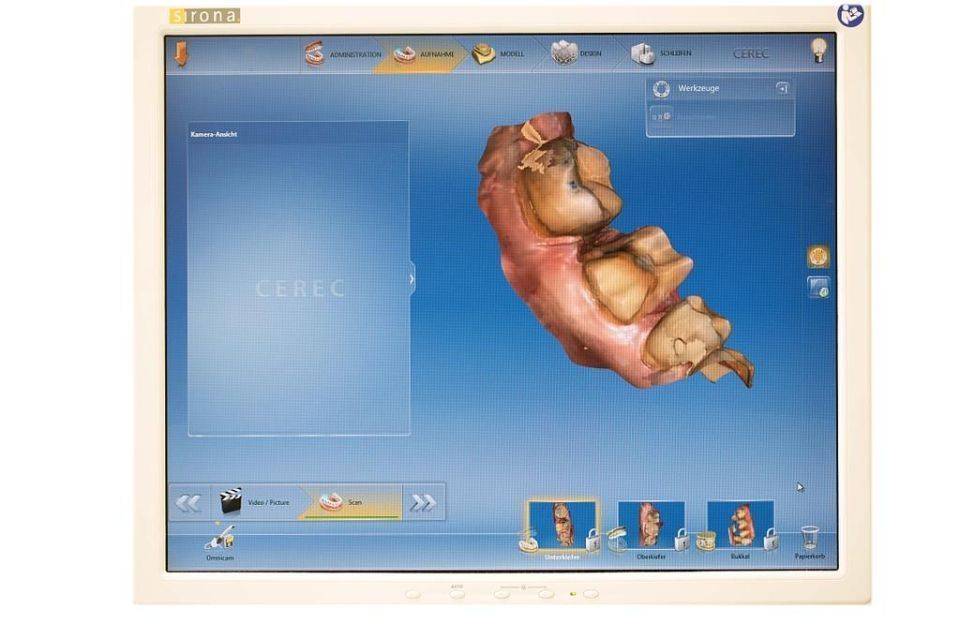 Cerec Screen - Zahnarztpraxis Cramm Muttenz
