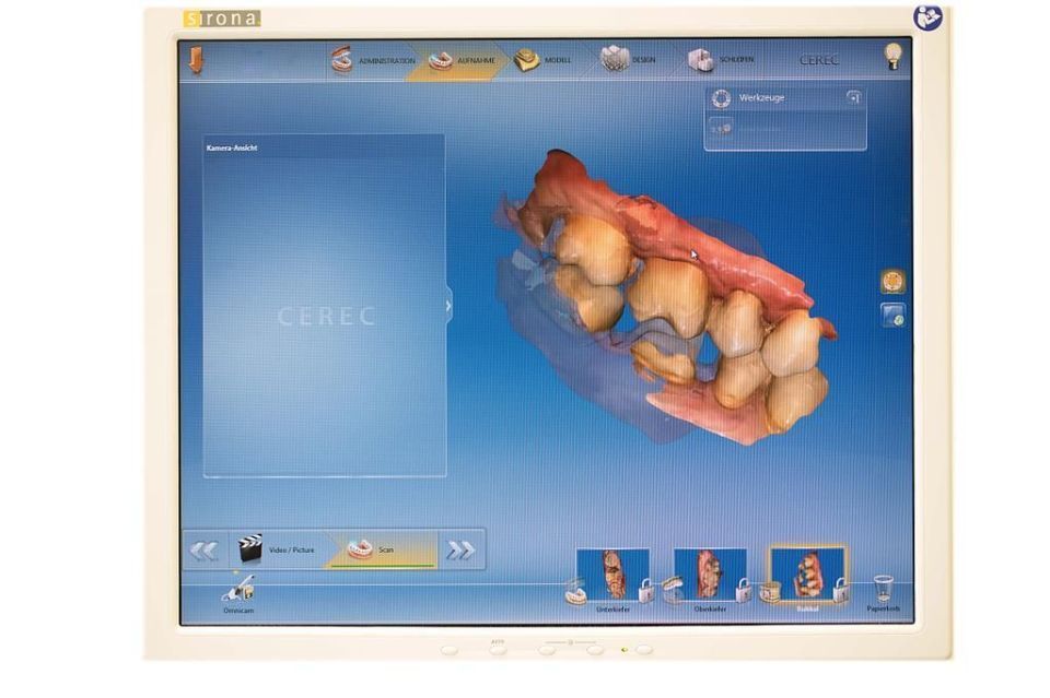 Cerec Scan - Zahnarztpraxis Cramm Muttenz
