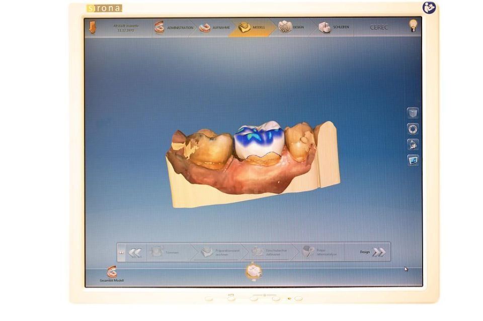 Cerec Screen - Zahnarztpraxis Cramm Muttenz
