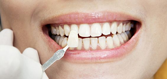 Cuidados básicos para el esmalte dental