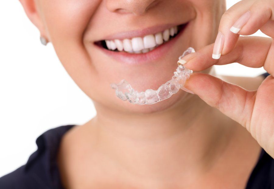 ¿Qué son los alineadores Invisalign?