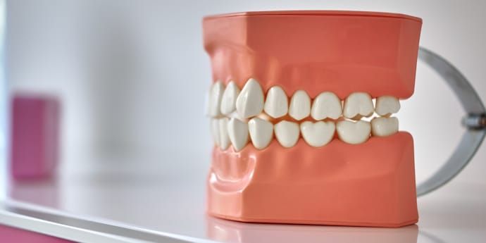 Ein Modell menschlicher Zähne in einem pfirsichfarbenen Kiefer vor einem verschwommenen Hintergrund.