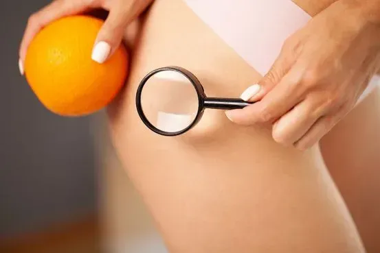 La mujer examina la piel del muslo con una lupa, hay una fruta naranja cerca.