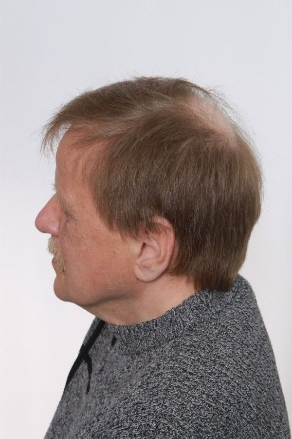 peruukkiliikehyvarinen