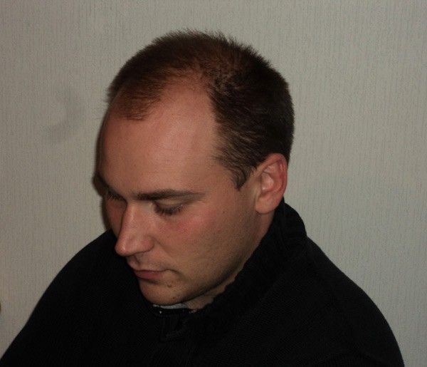 peruukkiliikehyvarinen