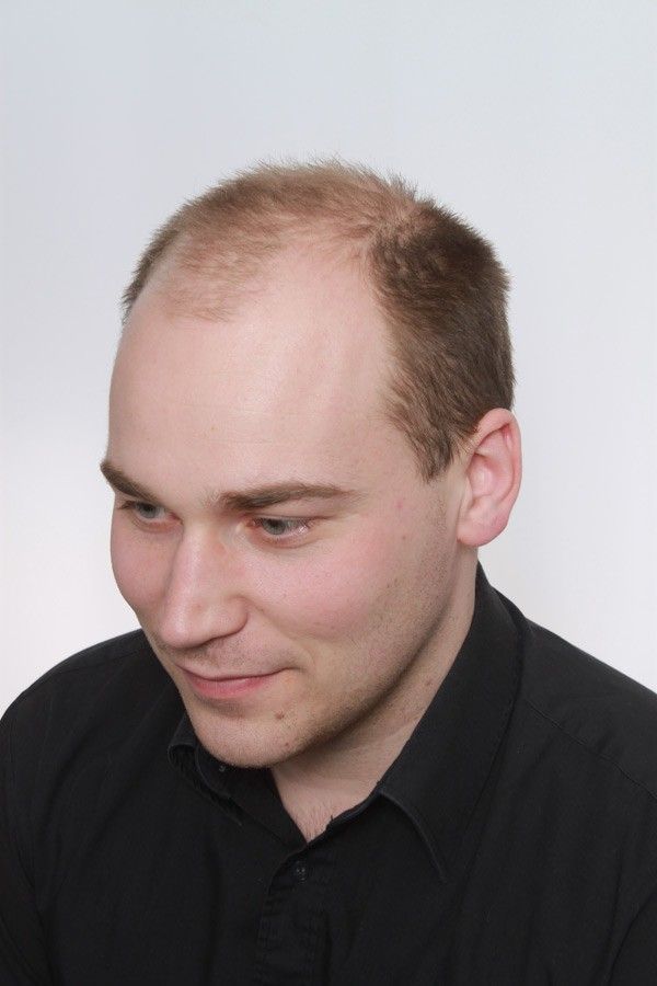 peruukkiliikehyvarinen