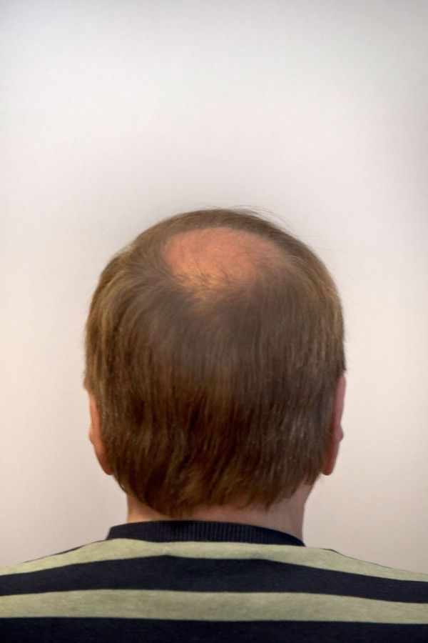 peruukkiliikehyvarinen