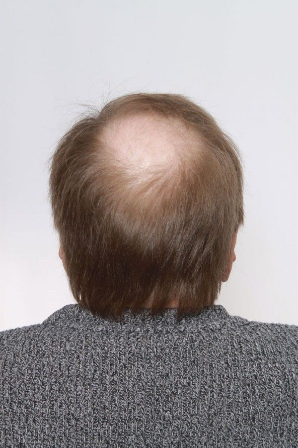 peruukkiliikehyvarinen