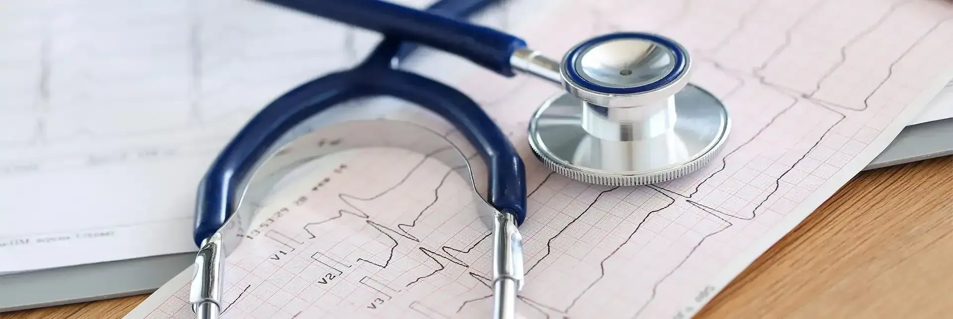 Un estetoscopio está sobre un ECG en una mesa.