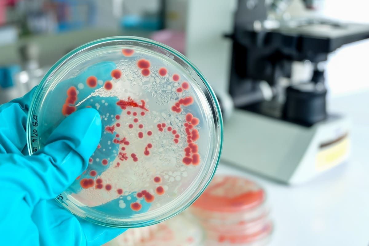 Una persona sostiene una placa de Petri con bacterias dentro.