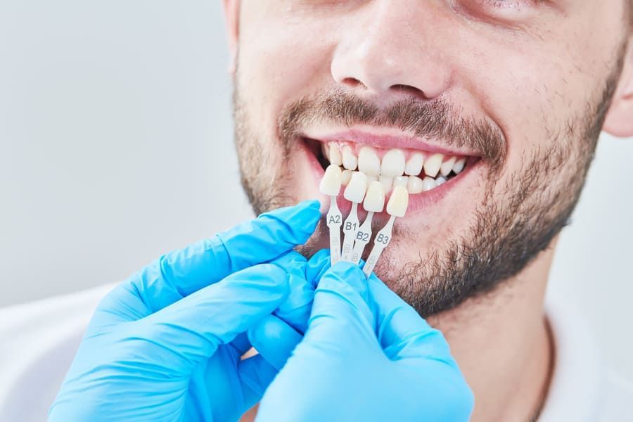 Un hombre se está blanqueando los dientes con un dentista.