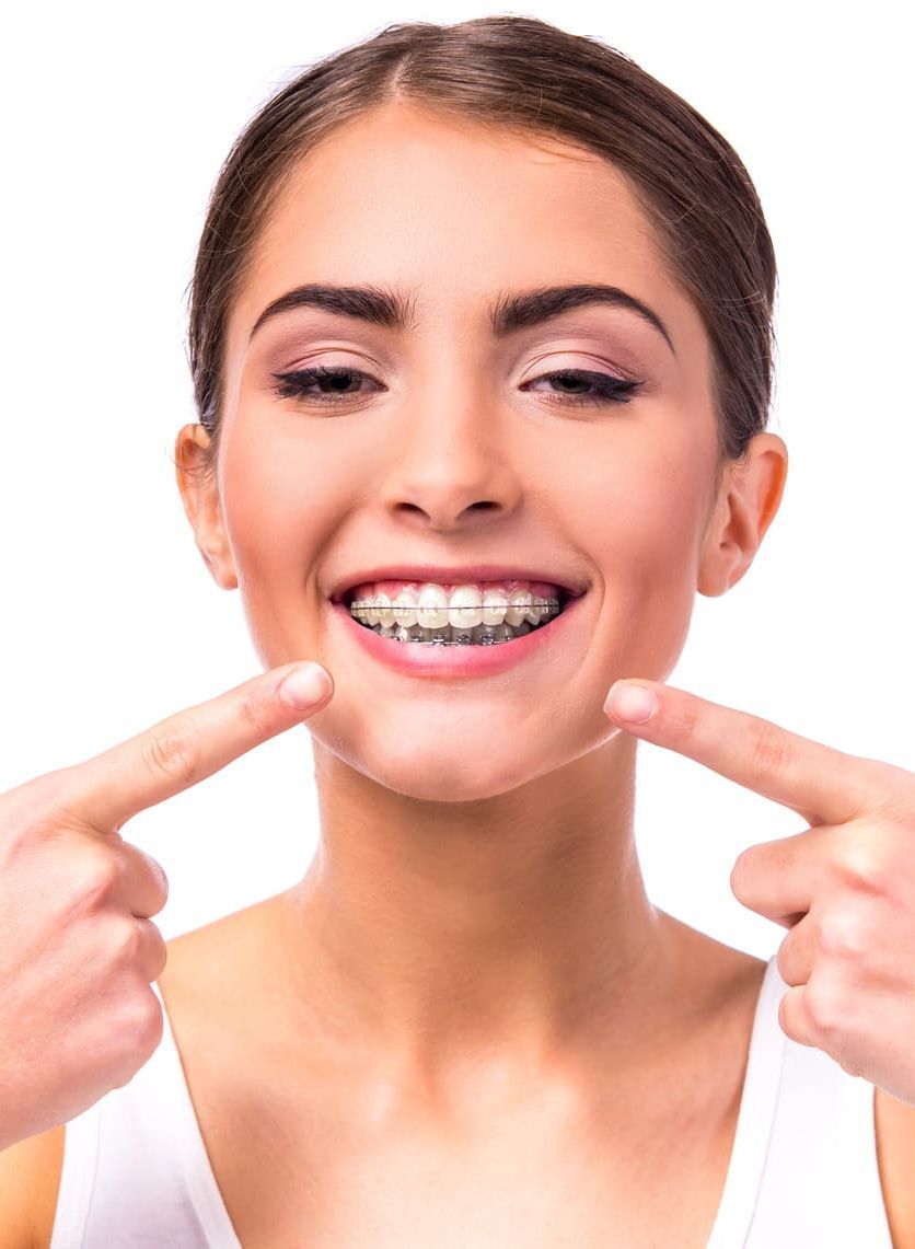 Una mujer con aparatos dentales sonríe y señala sus dientes.