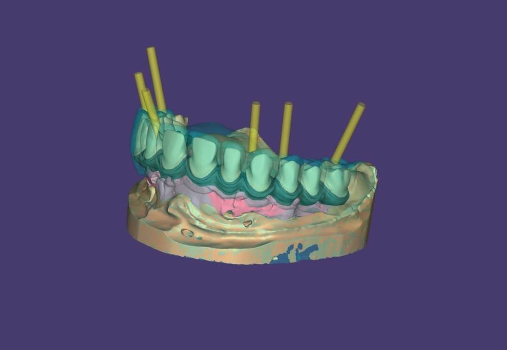 Capture d'écran d'un logiciel CFAO 20