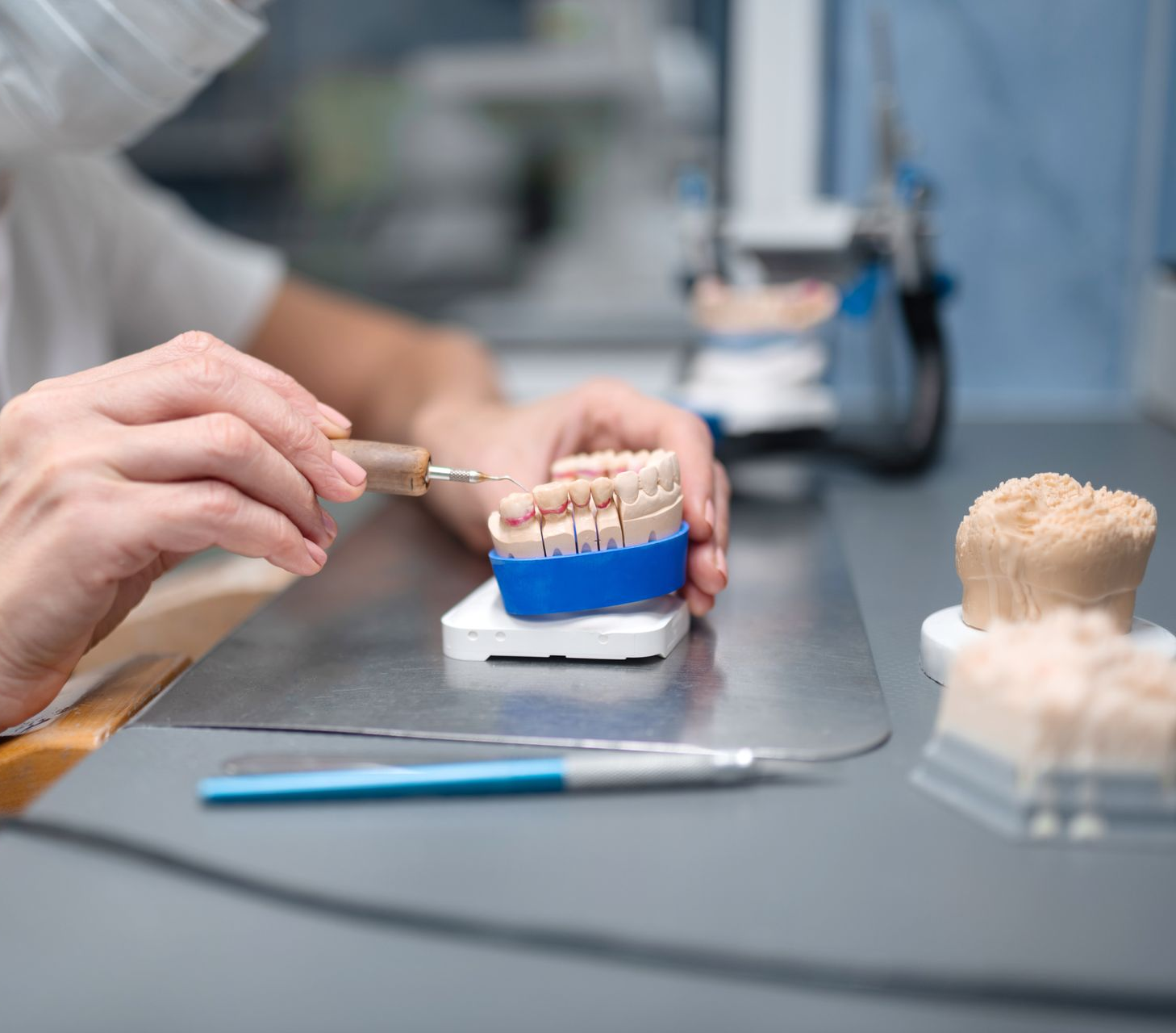 Fixation de prothèse conjointe en céramique sur un moule