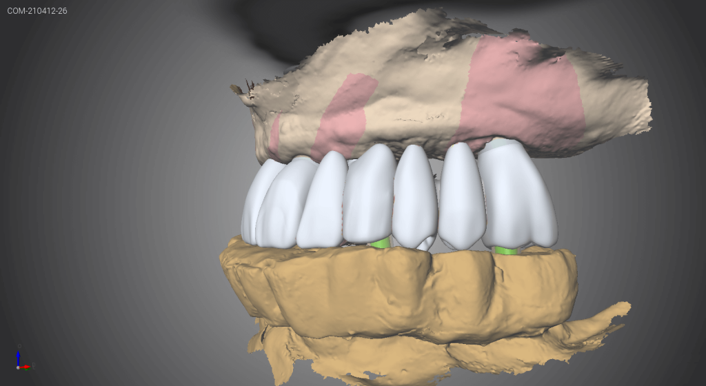 Capture d'écran d'un logiciel CFAO 18