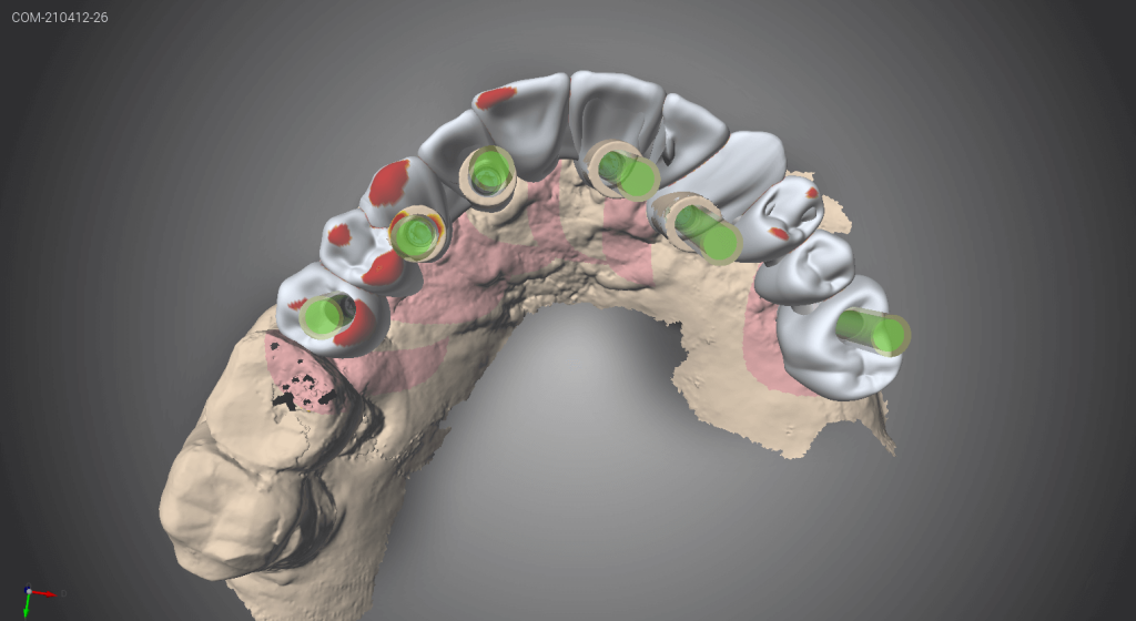 Capture d'écran d'un logiciel CFAO 15