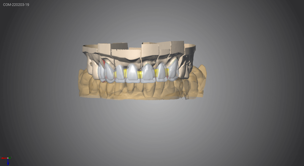 Capture d'écran d'un logiciel CFAO 2
