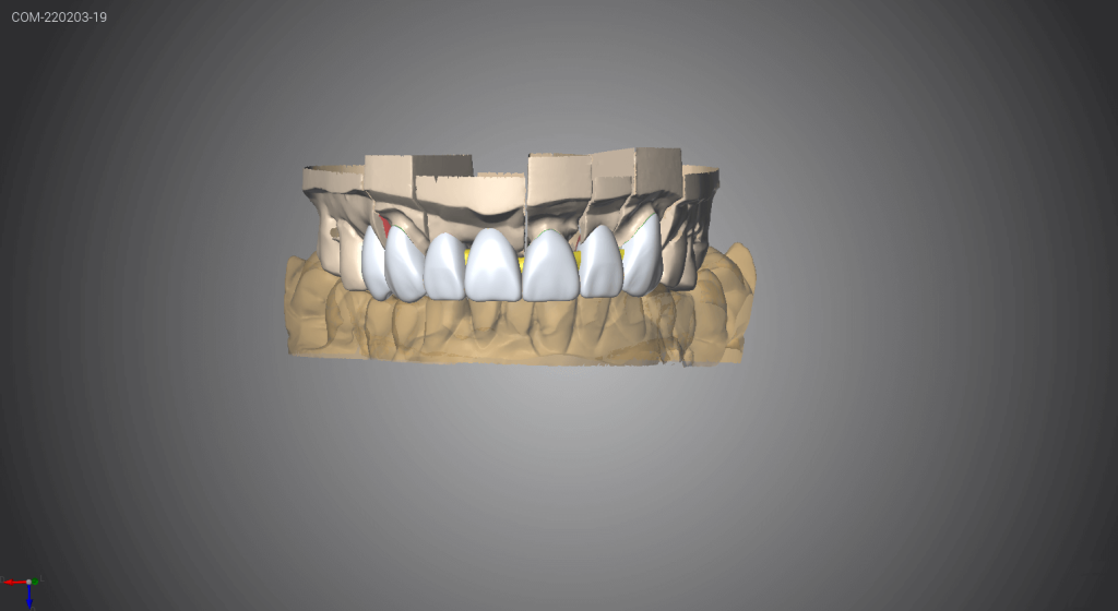 Capture d'écran d'un logiciel CFAO 5