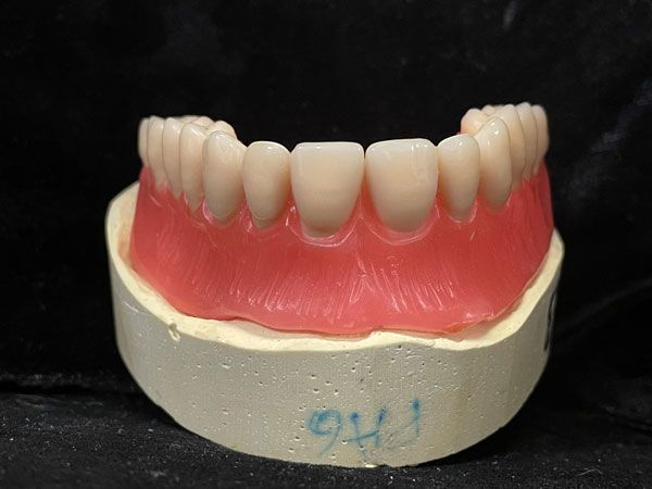 Dentier sur un moule