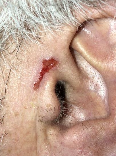 Eine Nahaufnahme eines Ohrs