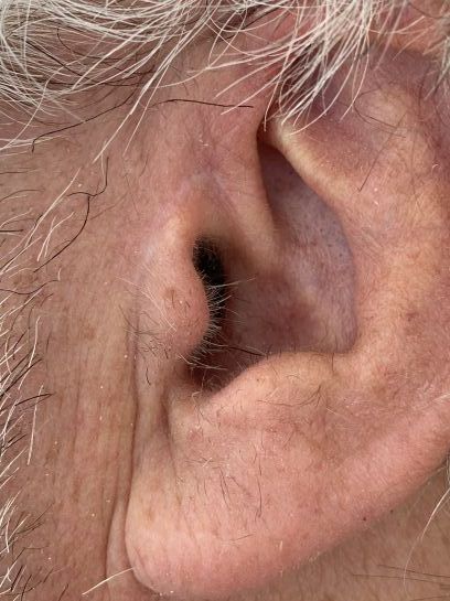 Eine Nahaufnahme des Ohrs eines älteren Mannes mit grauem Haar.