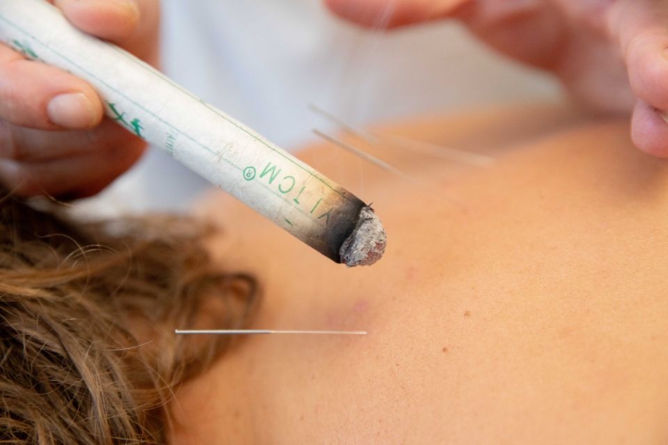 Person, die auf dem Rücken eine Schröpftherapie erhält, mit angelegten Saugnäpfen; Hände sind zu sehen.