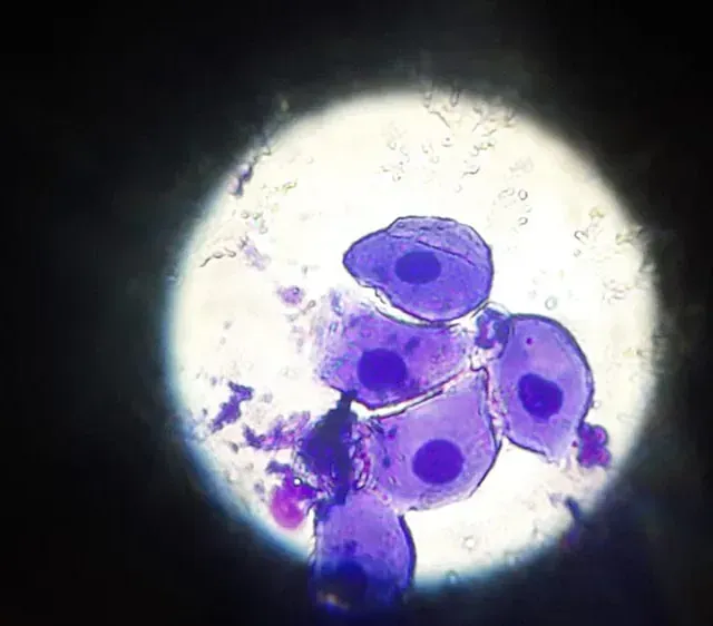 Un primer plano de una célula bajo un microscopio.