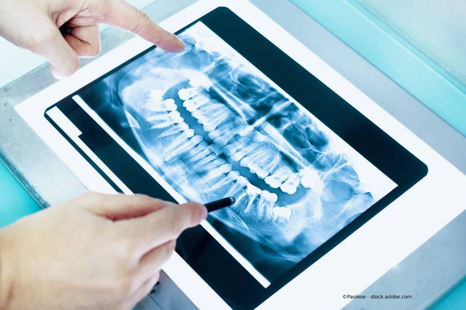 Digitales Röntgen von Zähnen