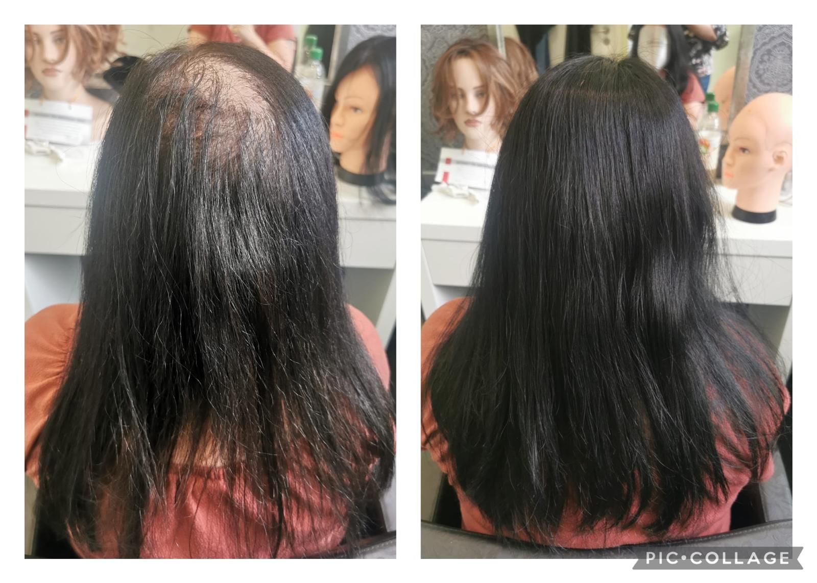 Vorher und nachher: ​​Eine Frau mit Haarausfall, dann mit vollem, langem, schwarzem Haar.