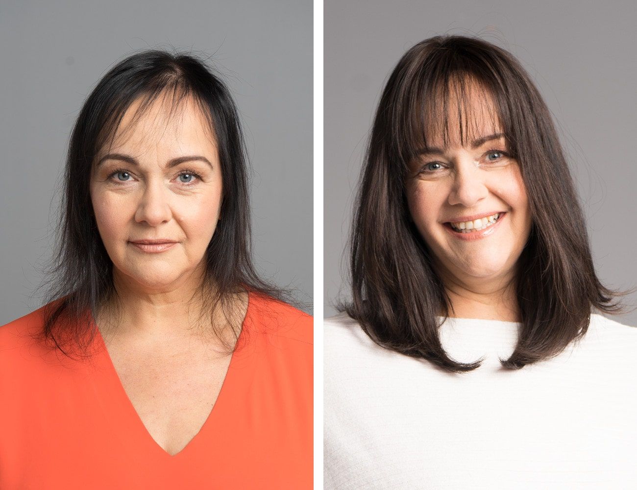 Vorher-Nachher-Fotos: Eine Frau mit schütterem Haar trägt jetzt eine neue Frisur mit Pony.