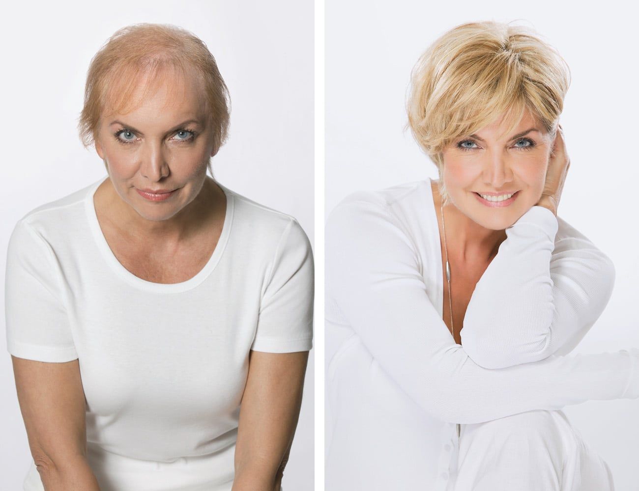Eine Frau mit Haarausfall, dann lächelnd mit blonder Perücke, beide in weißen Hemden.