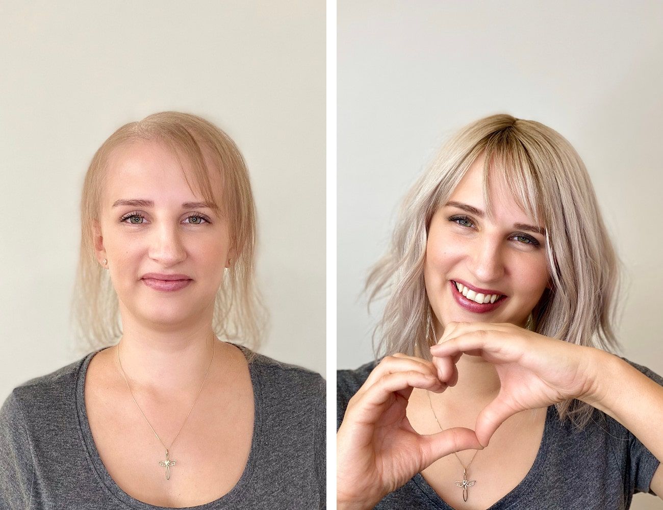Zwei Fotos: eine Frau mit schütterem Haar, die traurig aussieht, und dann eine lächelnde Frau mit neuem Haarschnitt, die mit ihren Händen ein Herz formt.
