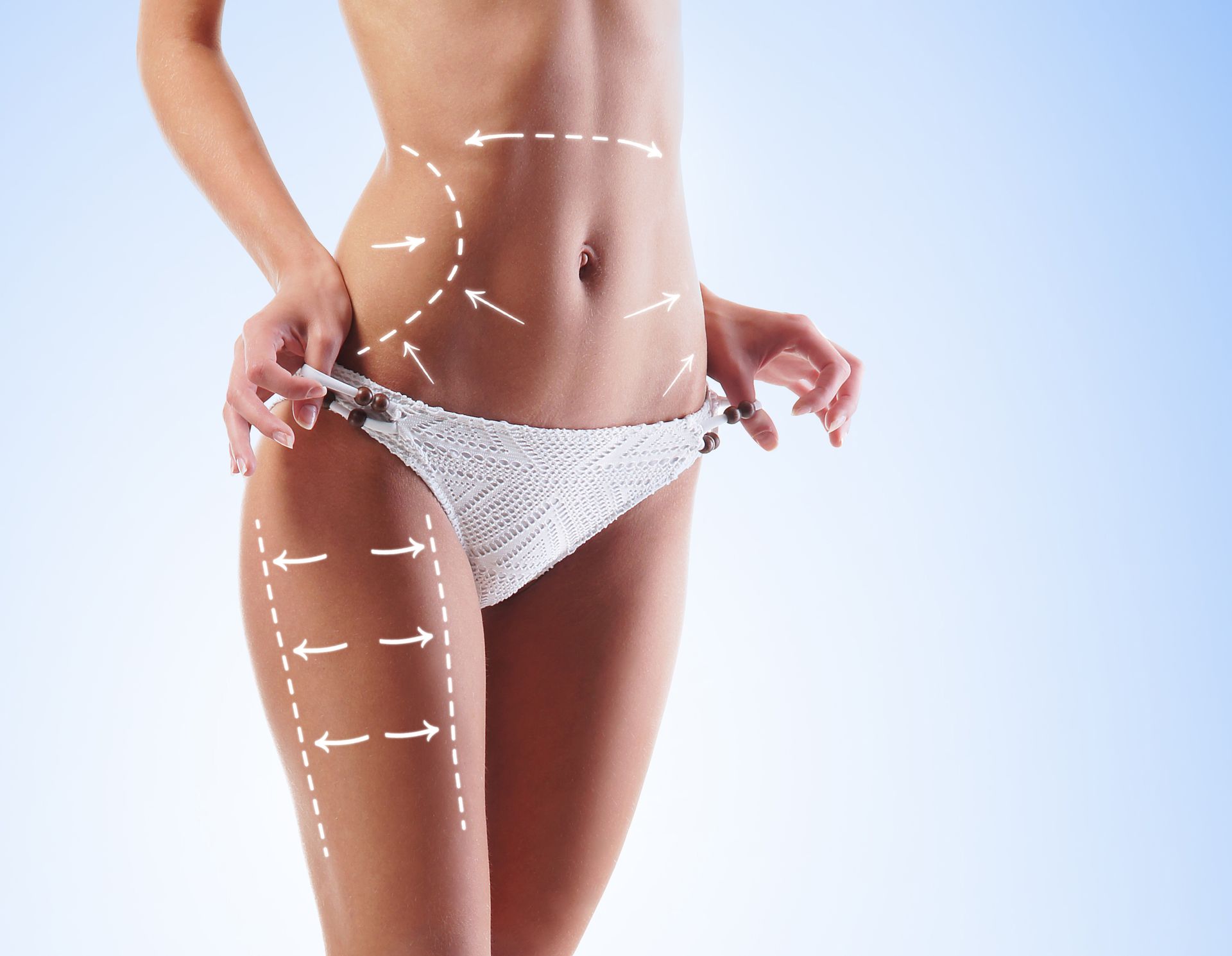 Femme en bikini blanc, flèches indiquant les zones à sculpter au niveau de l'abdomen et des cuisses.