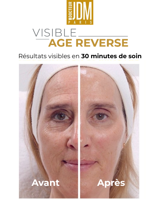 Le visage d'une femme illustre les effets d'un soin de la peau avant et après traitement.