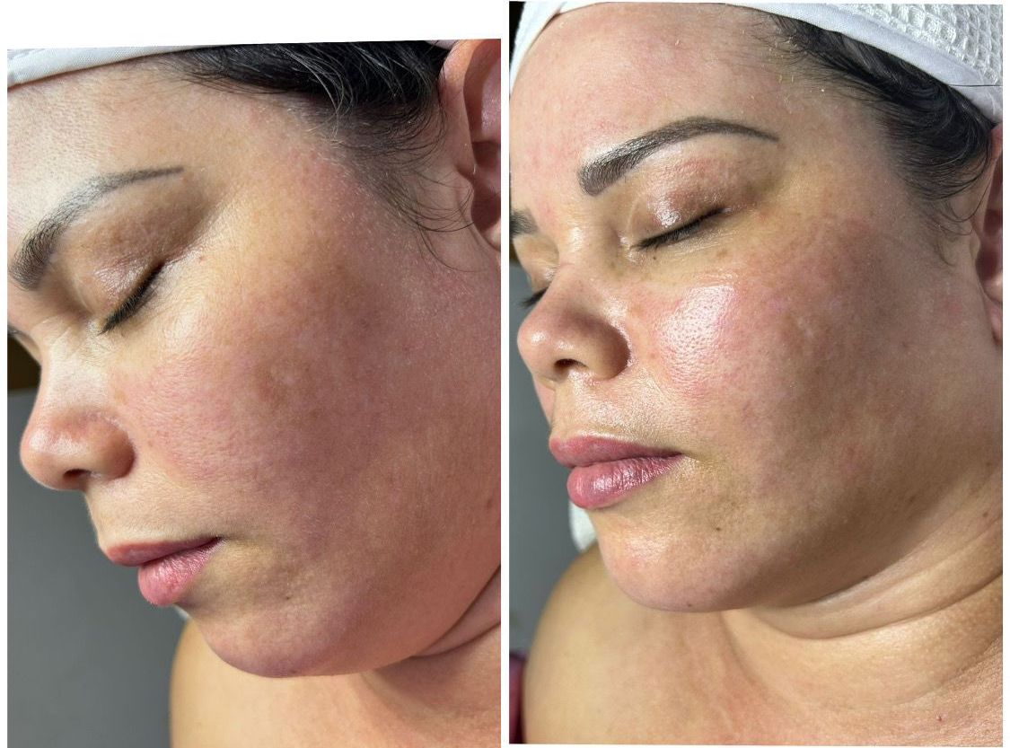 Una fotografía de antes y después del rostro de una mujer.