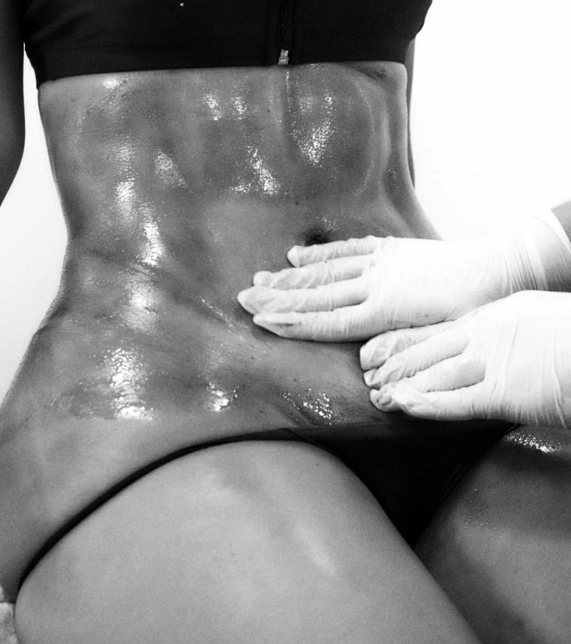 Una fotografía en blanco y negro de una mujer recibiendo un masaje.