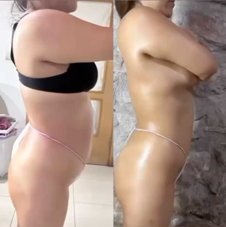 Una foto de antes y después de una mujer en bikini.
