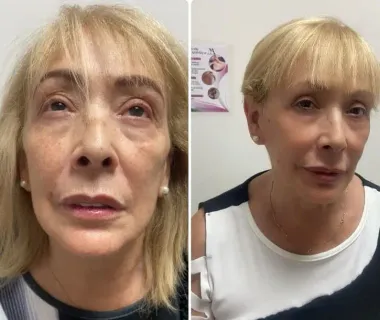 Un primer plano de las uñas de una mujer con la letra a en ellas.